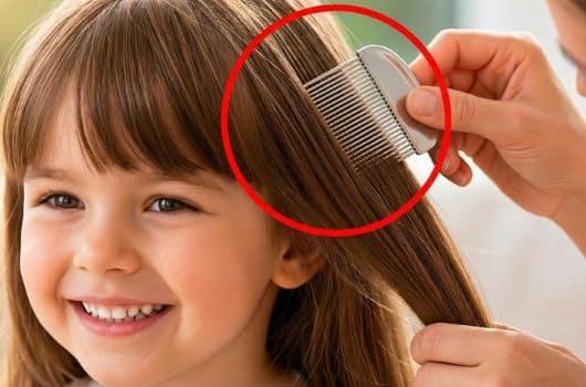receita caseira para acabar com o piolho